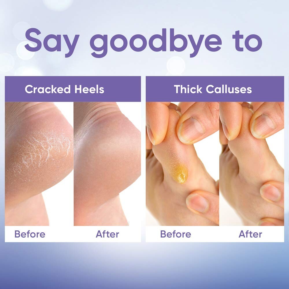 Foot Peel Mask(2 Pairs)- for Baby Soft Skin- Remove Dead Skin- SEALED OPENED BOX