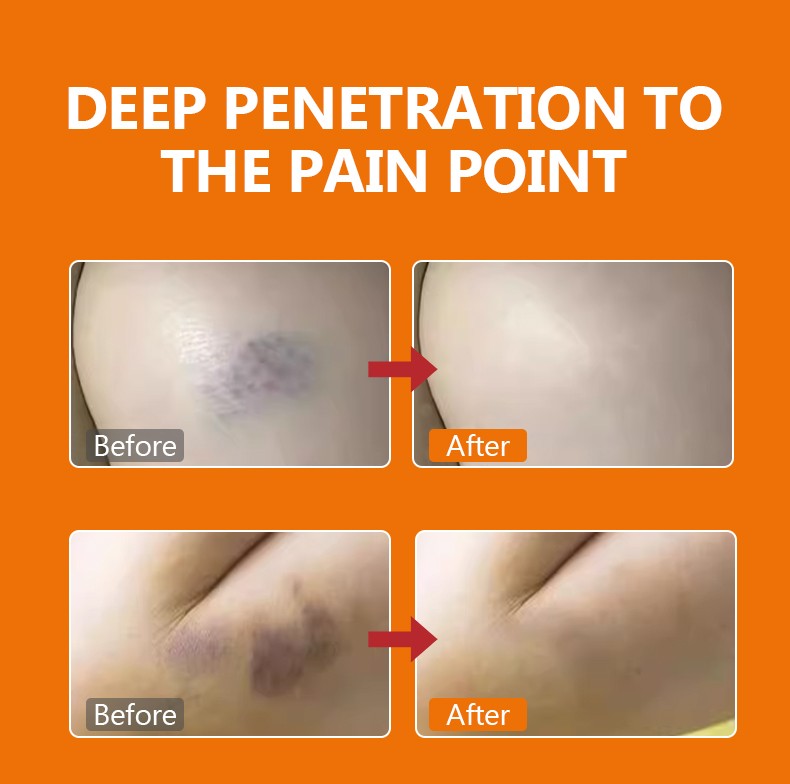 3OZ DERMFREE Topical Analgesic Ointment for Rapid Pain Relief in Muscles Joints