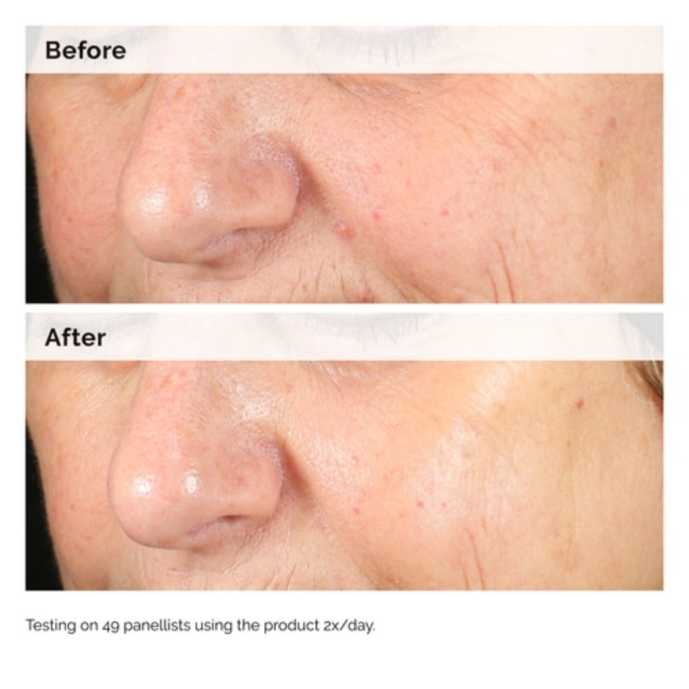 The Ordinary Authentic Alpha Arbutin 2% + Hyaluronic Acid Standard Or Value