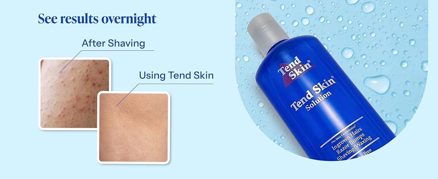 Tend Skin Solution 16 oz Razor Bump Ingrown Hair Treatment (Lot Of 2) USA 🆓🚚