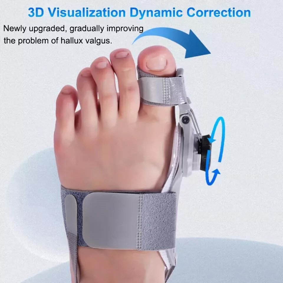 Treatmedy Bunion Fix Toe Valgus Corrector Adjustable Orthosis Women Men Splints