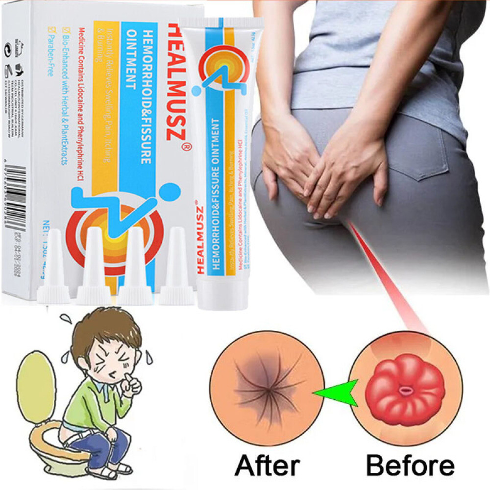 3/5PCS Hemorrhoids Remove Ointment Herbal Cream Relief Piles Pain Reduce Itching