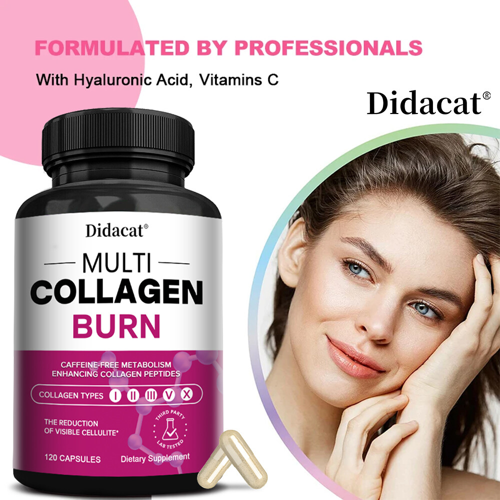 Multi Collagen Burn Capsules for Weight Loss – Hydrolyzed Collagen Peptides