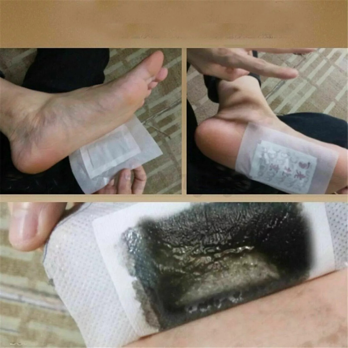 150PCS Detox Foot Patches Pads Body Toxins Feet Slimming Deep Cleansing Herbal