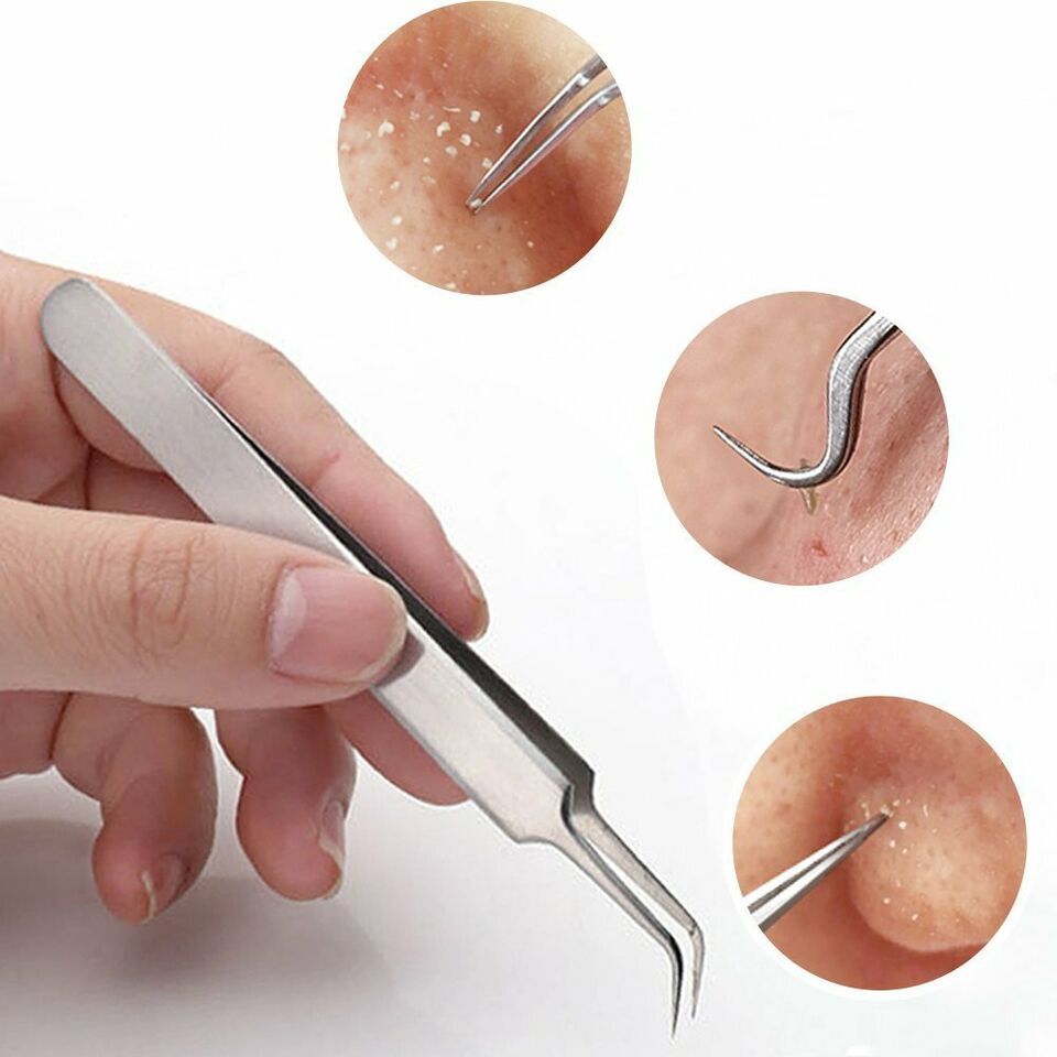 Portable Acne Removal Kit Easy to Use Face Cleansing Blackhead Extraction Tool