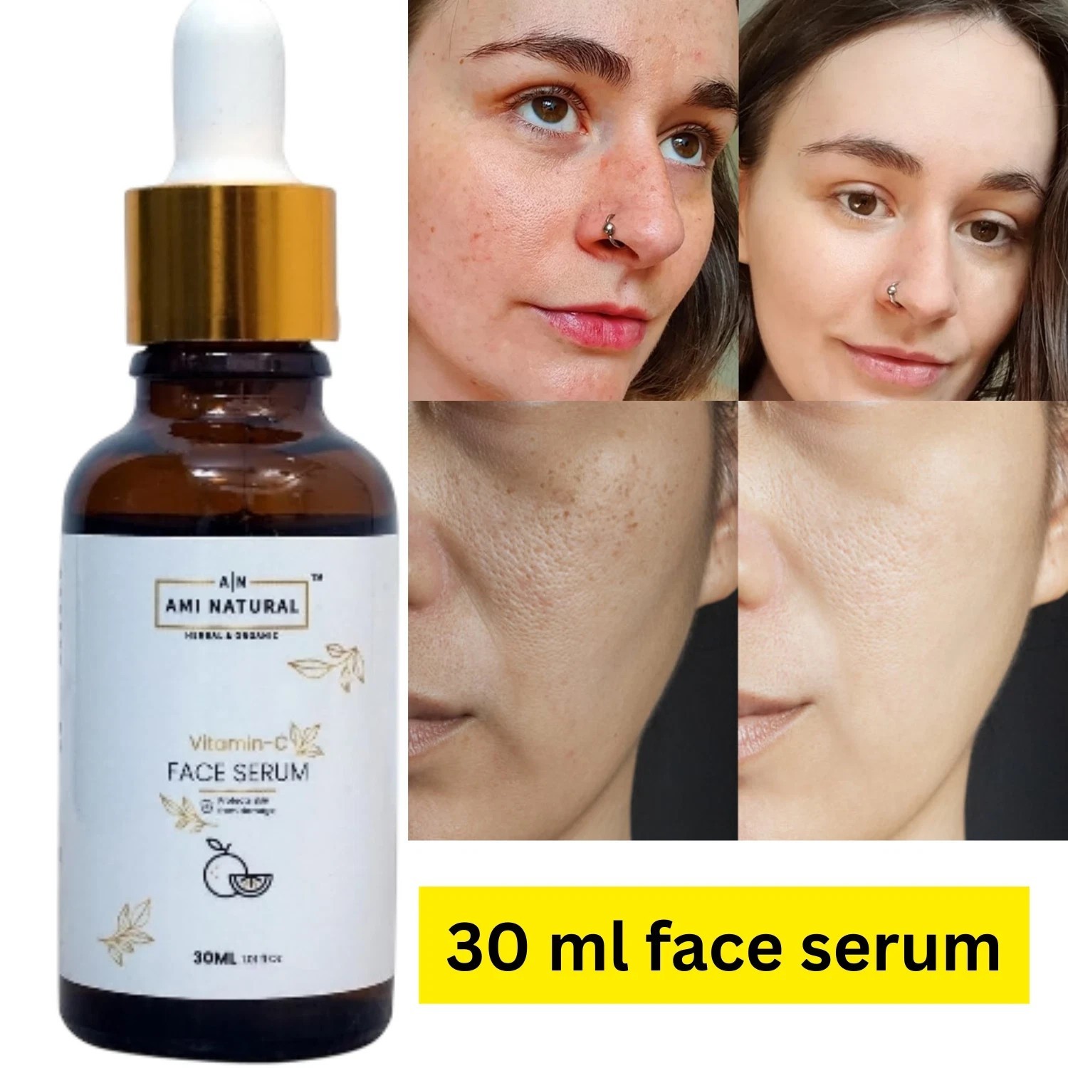 Ami Natural Vitamin C Face Serum for improve skin texture and glow – 30 ml