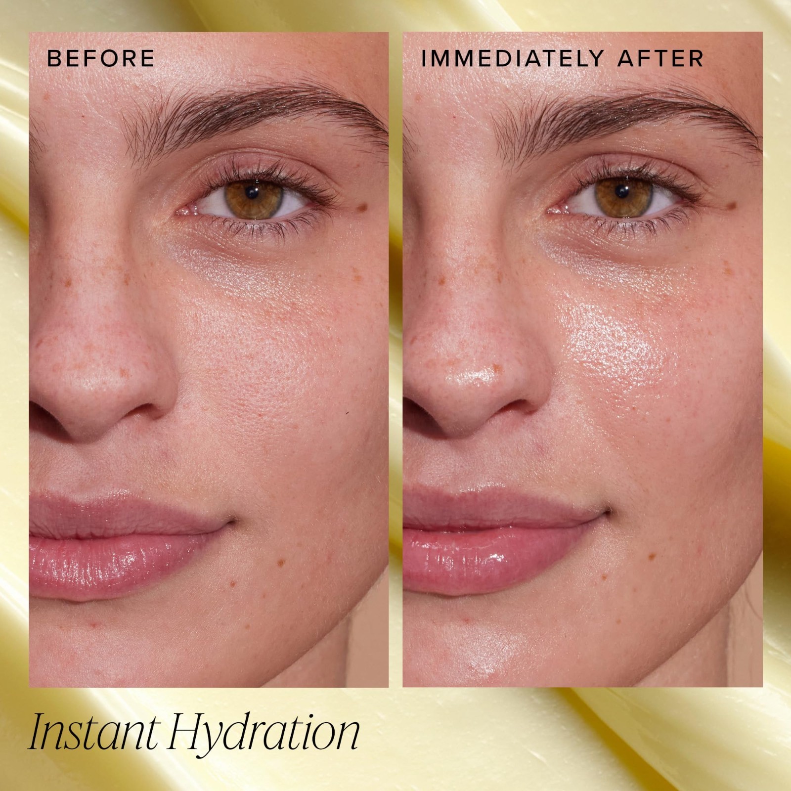 Hydrating Ceramide Face Moisturizer for Dry Skin – Plumps, Soothes & Restores Gl
