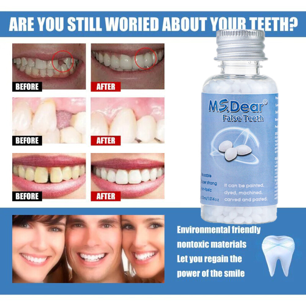 Permanent Strong Teeth Tooth Repair Dental Cement Cavity Filling Kit Fake Teeth.