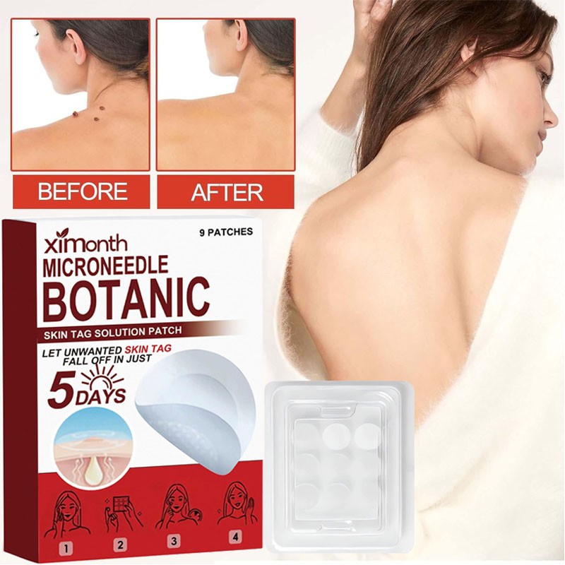 1-5 *Box MICRONEEDLE BOTANIC Skin Tag & Acne Patch Skin Tag Remover Patches