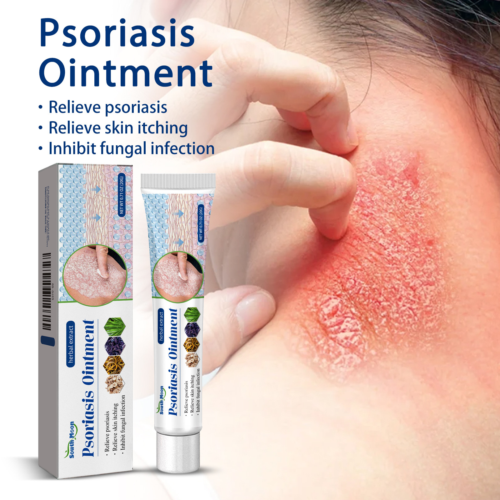 2 X Psoriasis Dermatitis Eczema Natural Cream Skin Treatment Ointment
