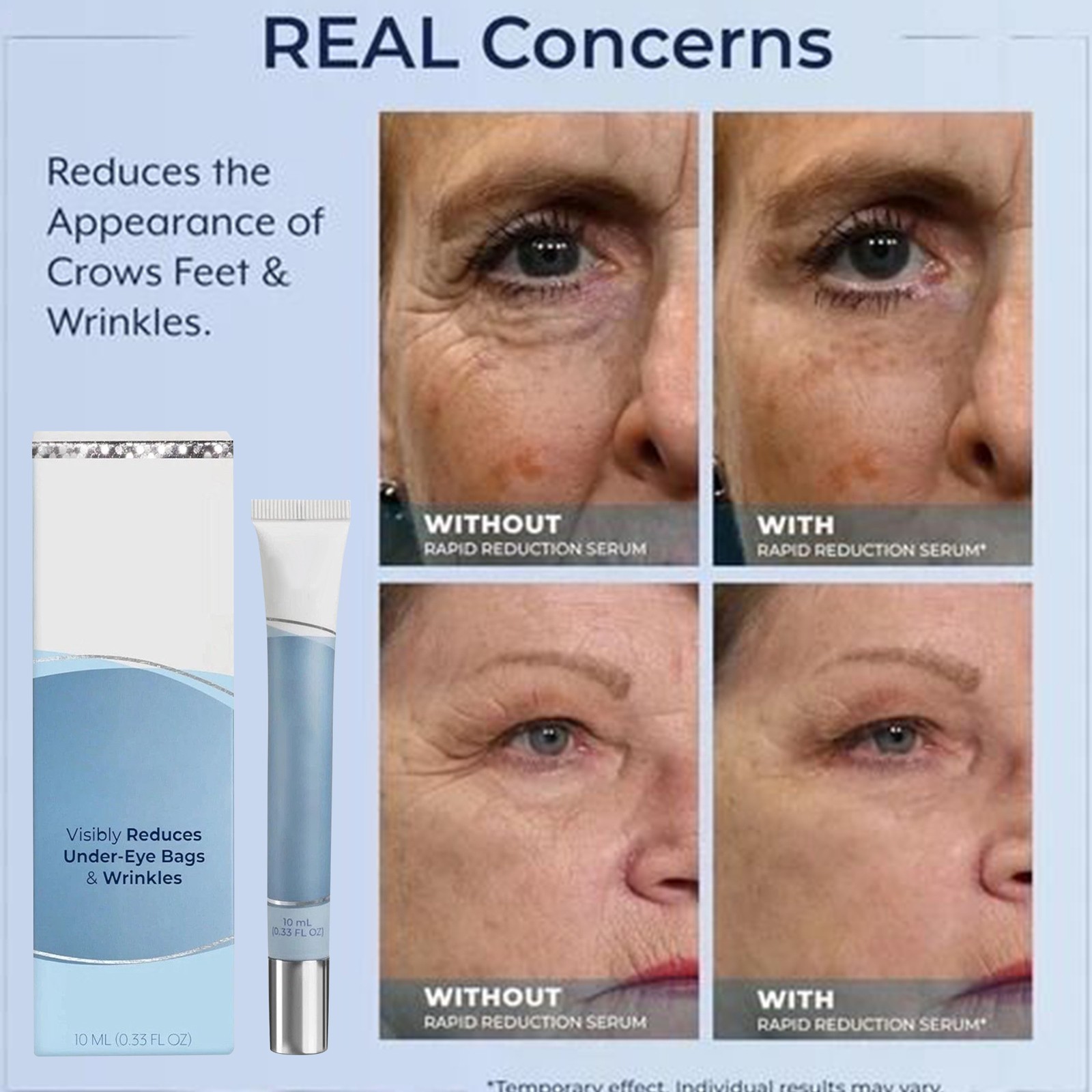Plexaderm Rapid Reduction Eye Serum-Advanced Formula Anti Aging Wrinkles 10ml