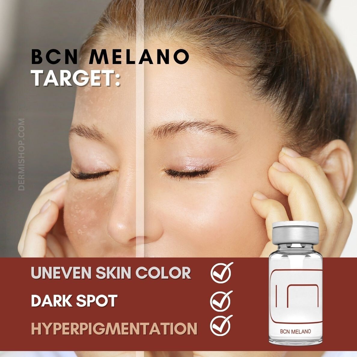 MELANO Advanced Dark Spot Serum, Hyperpigmentation Serum, BCN