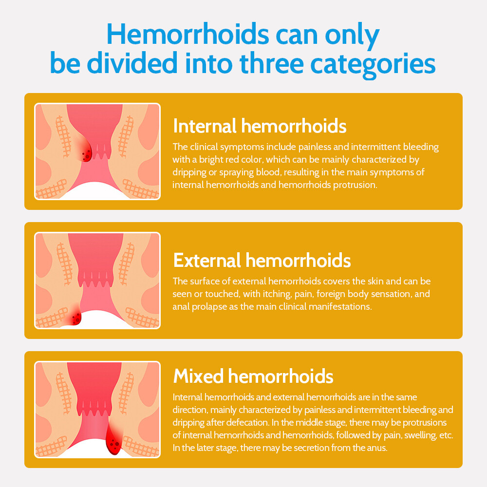 3/5PCS Hemorrhoids Remove Ointment Herbal Cream Relief Piles Pain Reduce Itching