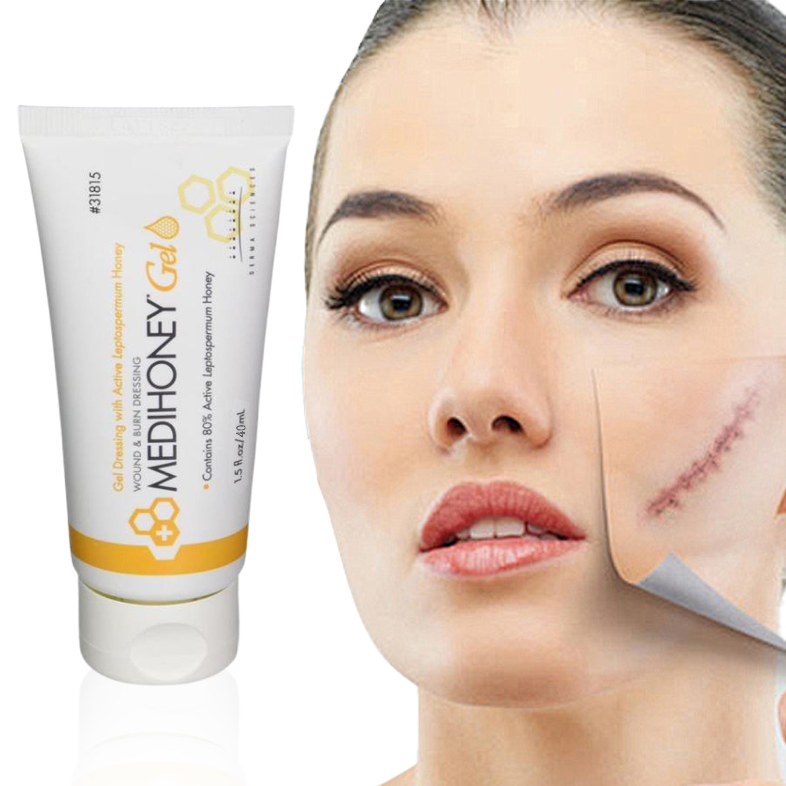 MEDI~HONEY & Gel 40ml Burn Dressing Gel Wound Silicone Scar ENHANCED Premium