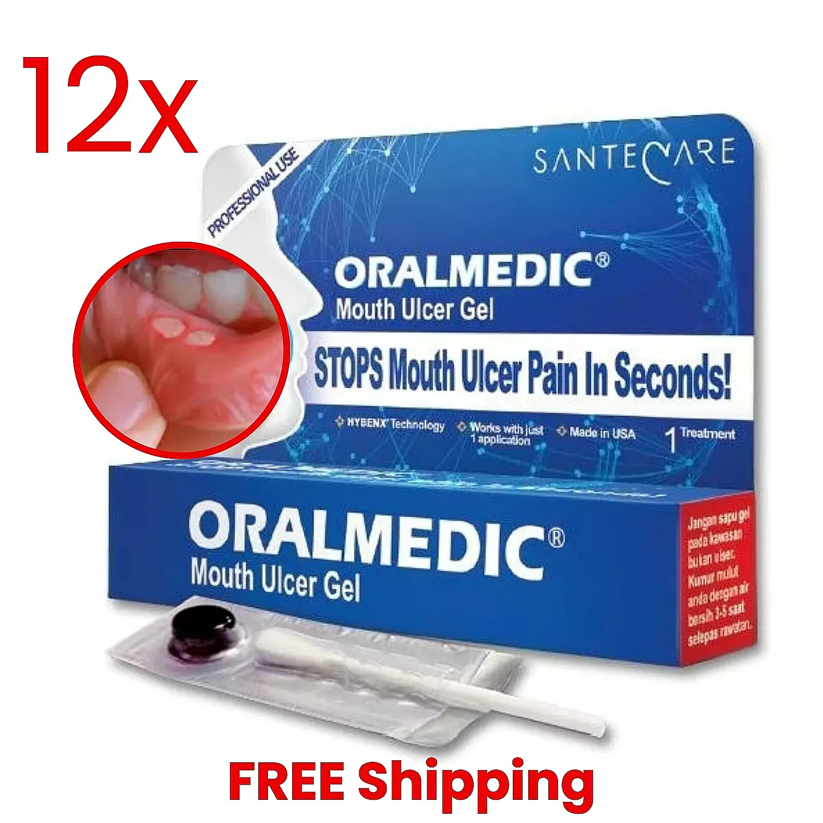 (Pack of 12 ) Oralmedic Mouth Ulcer Gel 1 Treatment Fast Pain Relief Made in USA