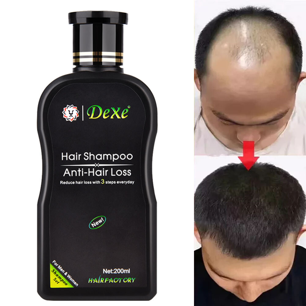 200ml Regeneration Regrowth Hair Growth Shampoo Natural Anti Hair Loss Treatment