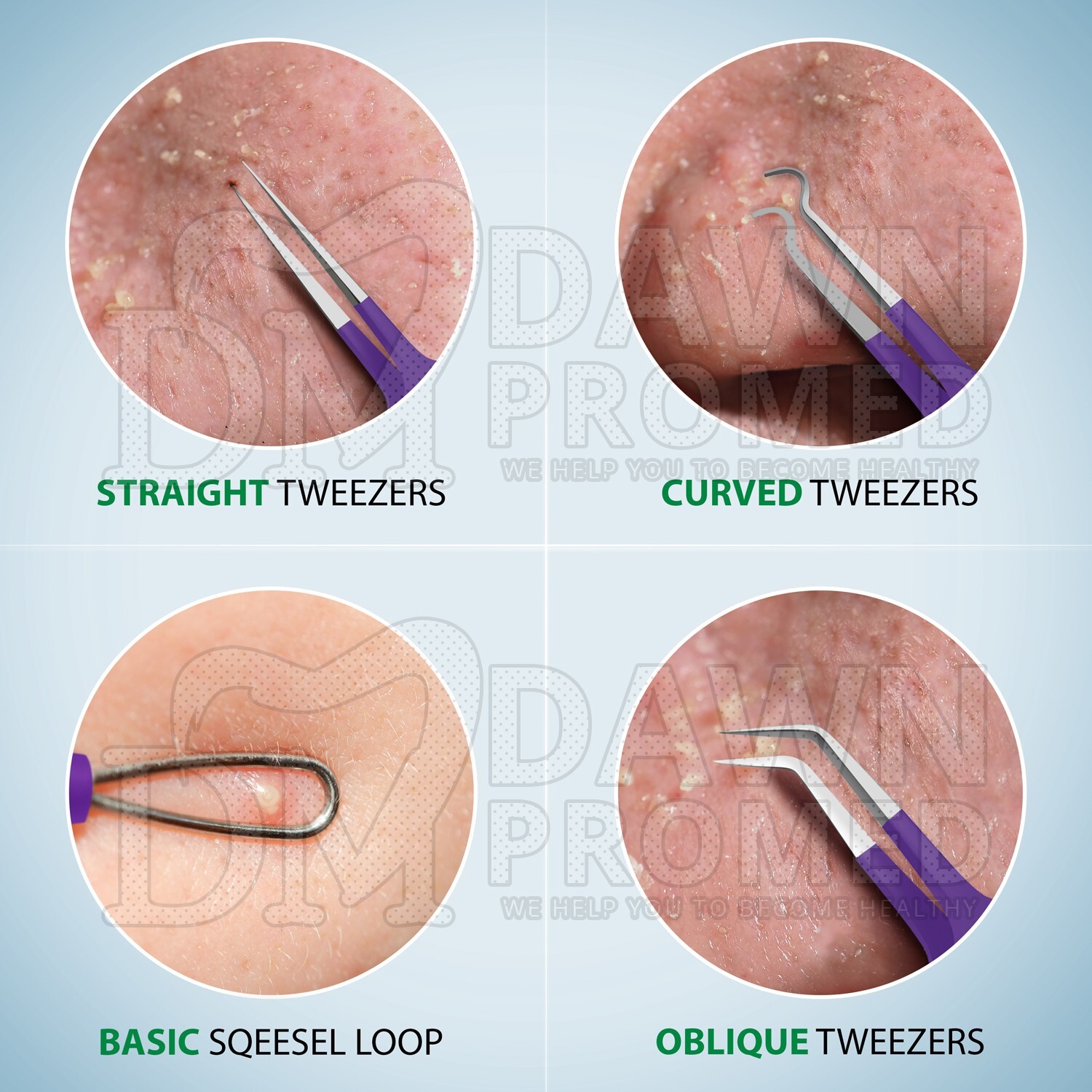 10 Pcs Pimple Popper Blackhead Remover Kit Tools Set Comedone Zit Extractor