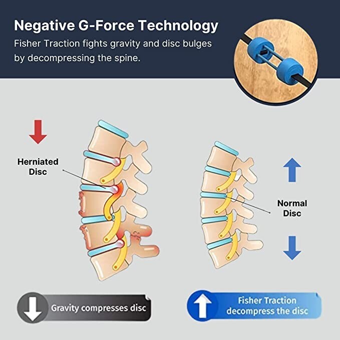 Fisher Traction® Low Back Device.