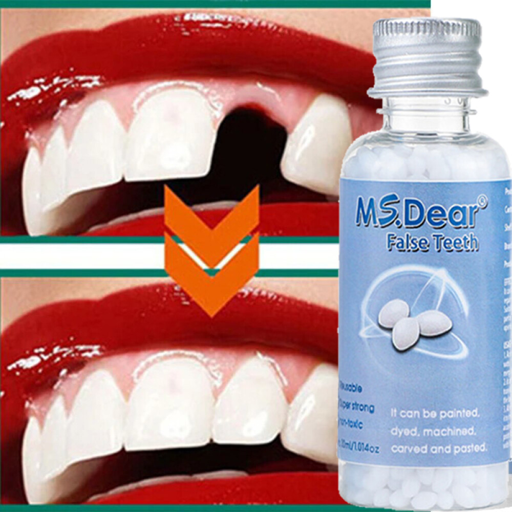 Permanent Strong Teeth Tooth Repair Dental Cement Cavity Filling Kit Fake Teeth.