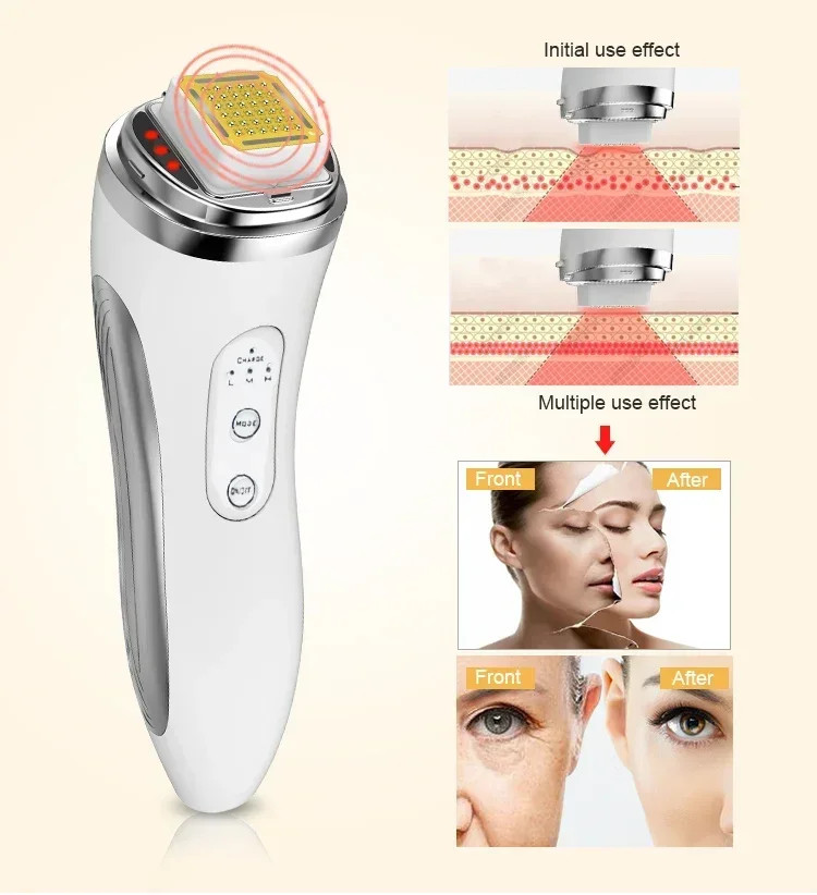 RF Face Lifting Machine Anti Aging Skin Tightening Beauty Device Wrinkle Remover