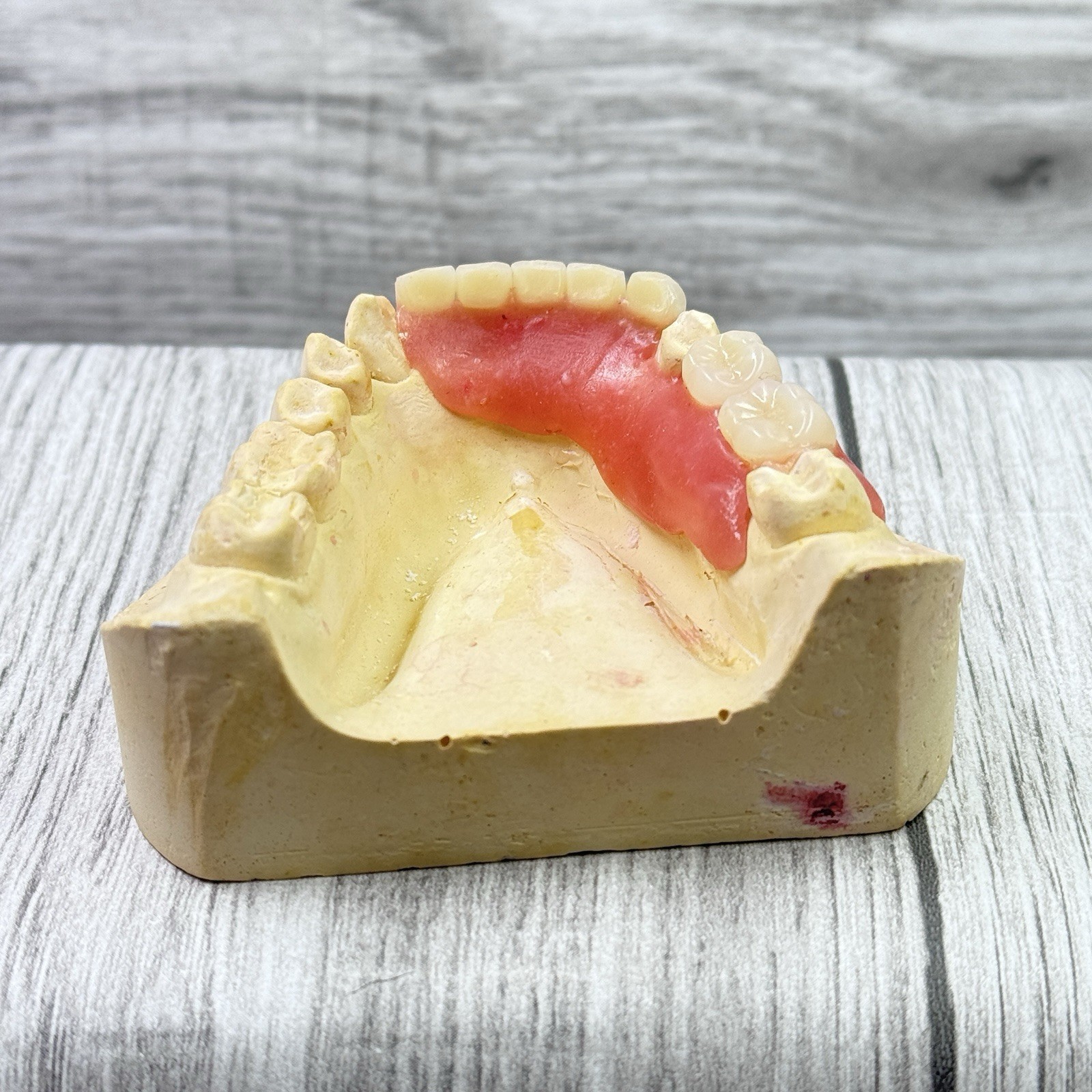 Partial Denture Kit Make Your Own Custom Denture Affordable Temporary Teeth A2