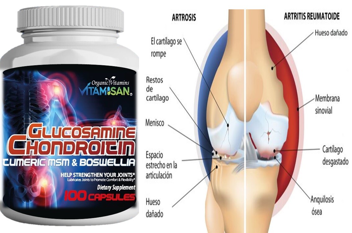 Support ARTHRITIS BION vitamin joints support 100 Capsules glucosamine MSM