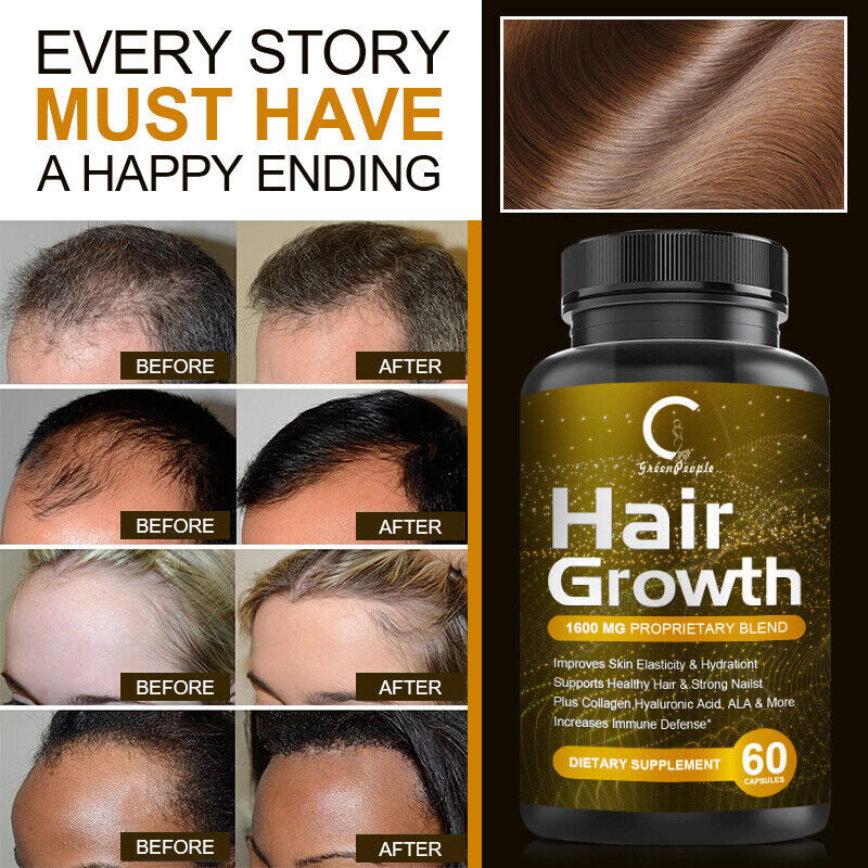 HAIR FAST GROWTH HERBAL PILLS PREVENT ANTI LOSS STIMULATE VITAMINS PILLS 5000MG