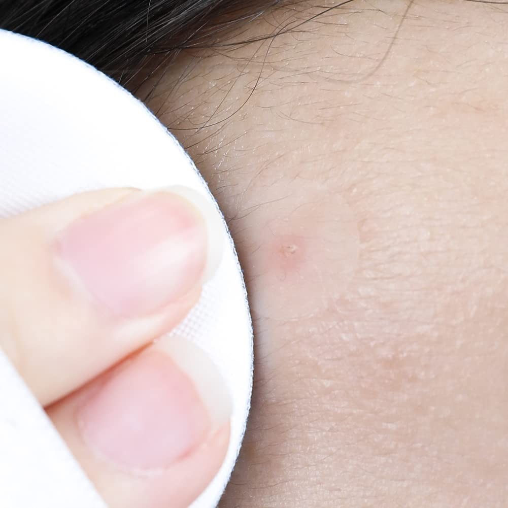 Effective Hydrocolloid Acne Spot Patch – 12mm | & Not Tested on Animals